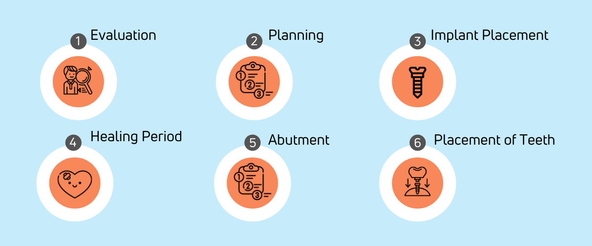 Dental Implant Procedure Step by step